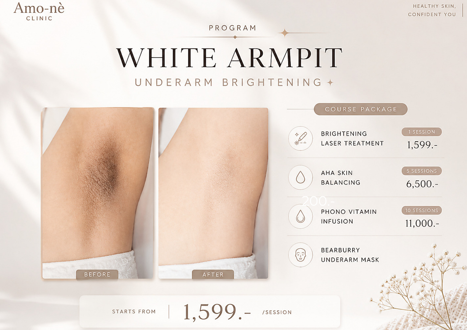 White Armpit